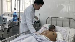 Vụ nổ xe bồn ở Bình Phước, 6 người chết: Tài xế đang nguy kịch