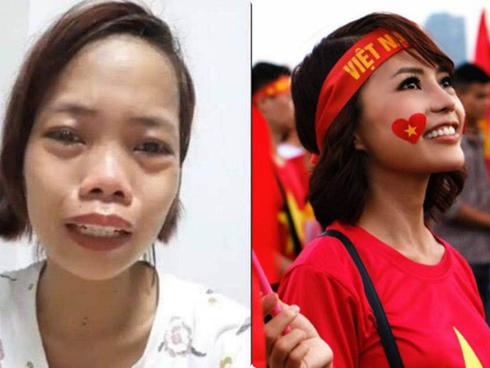 Top 3 cuộc phẫu thuật thẩm mỹ đổi đời gây xôn xao mạng xã hội năm 2018-14