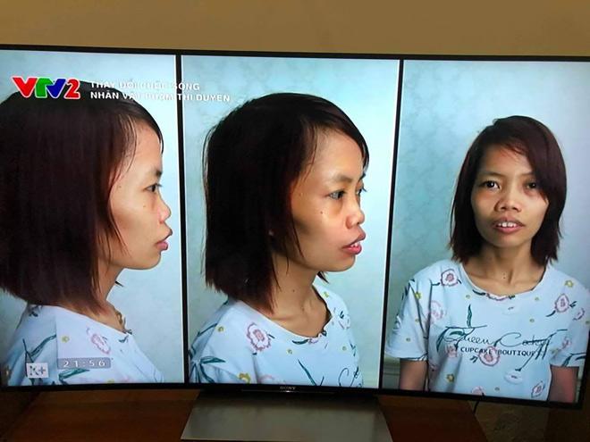 Không còn giấu giếm, mẹ đơn thân từng bị chê xấu xúc phạm người nhìn tự tin đăng ảnh xinh đẹp hậu thẩm mỹ-3