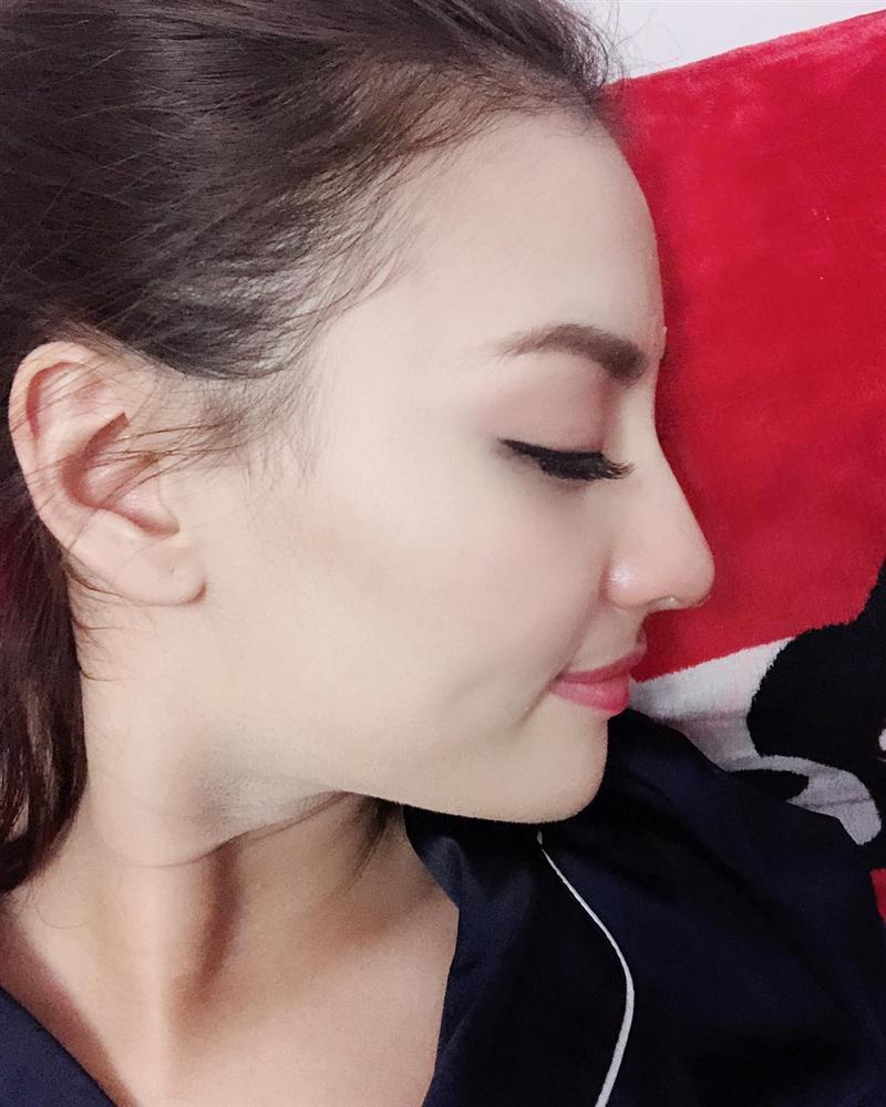 Nâng mũi mà bị phản đối dữ dội, Hồng Quế phân trần: Tôi đổi tướng số cho vận mệnh tốt hơn-3