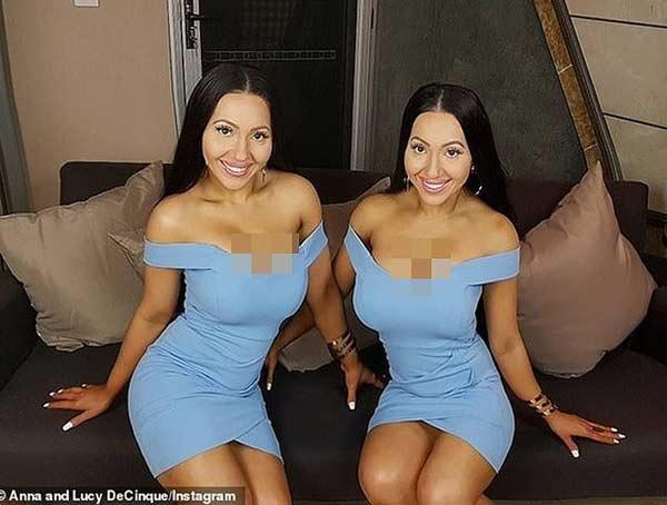 Hai chị em phẫu thuật giống búp bê tình dục để giữ chân người yêu chung-1