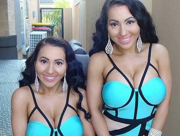 Hai chị em phẫu thuật giống búp bê tình dục để giữ chân người yêu chung-10