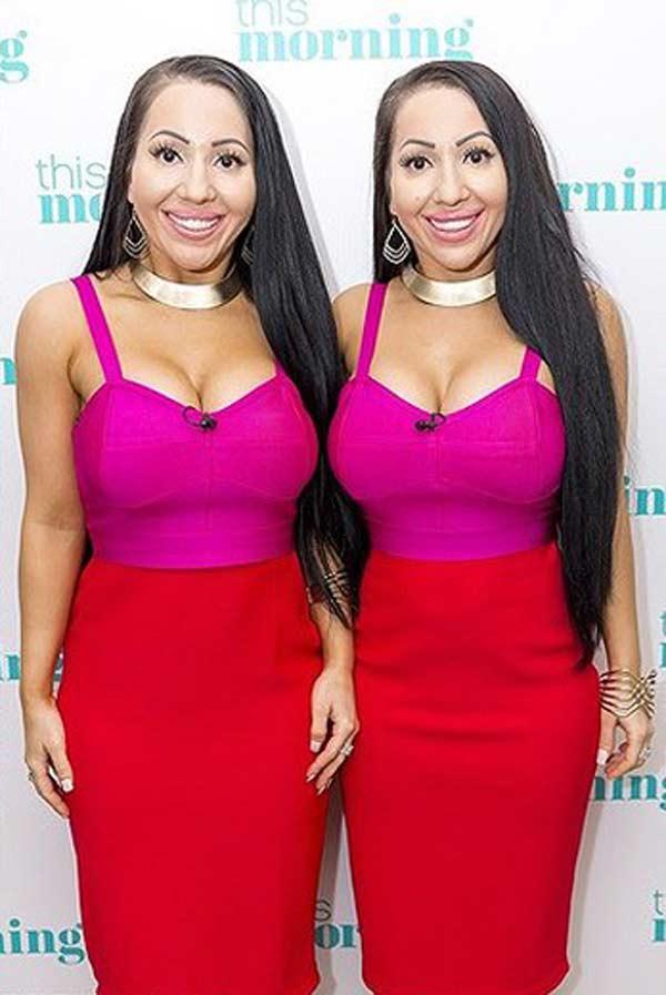 Hai chị em phẫu thuật giống búp bê tình dục để giữ chân người yêu chung-4