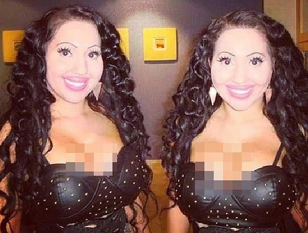 Hai chị em phẫu thuật giống búp bê tình dục để giữ chân người yêu chung-6