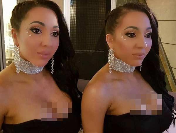 Hai chị em phẫu thuật giống búp bê tình dục để giữ chân người yêu chung-8