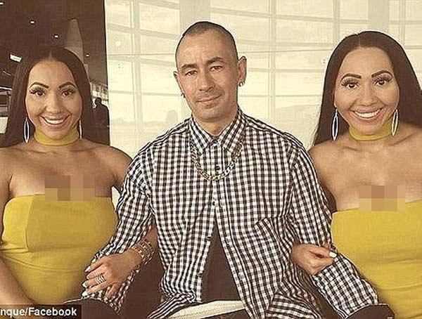 Hai chị em phẫu thuật giống búp bê tình dục để giữ chân người yêu chung-9