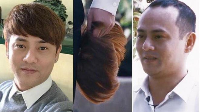 Bị hói, ca sĩ Ưng Đại Vệ quyết định cấy 2000 sợi tóc-4