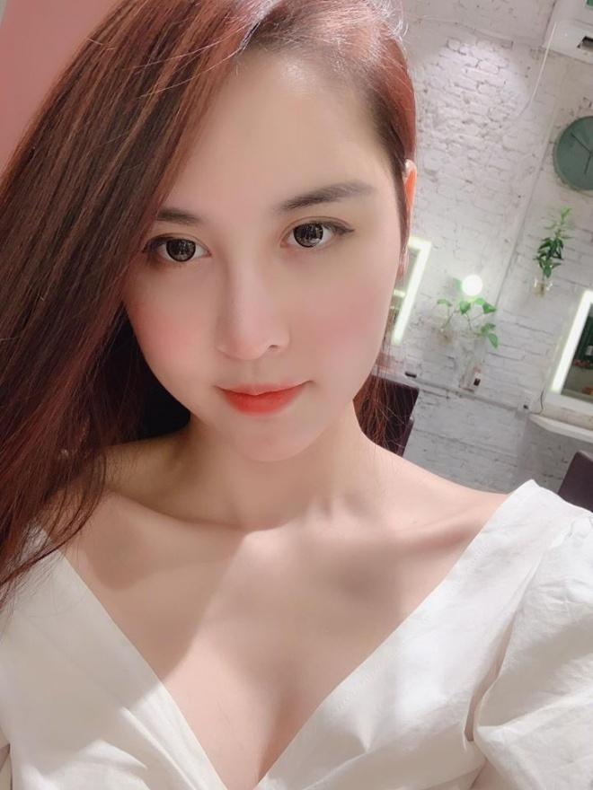 Sau 11 ngày phẫu thuật thẩm mỹ, Hà Lade lên tiếng khi bị chê gương mặt quá đại trà, đơ cứng-1