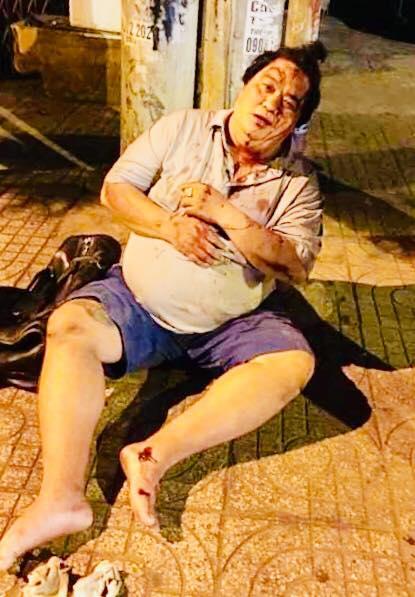 Nghệ sĩ Hoàng Mập bị tai nạn giao thông, thương tích khắp người-1