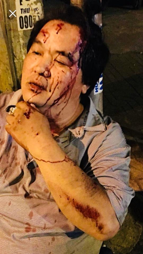 Nghệ sĩ Hoàng Mập bị tai nạn giao thông, thương tích khắp người-2