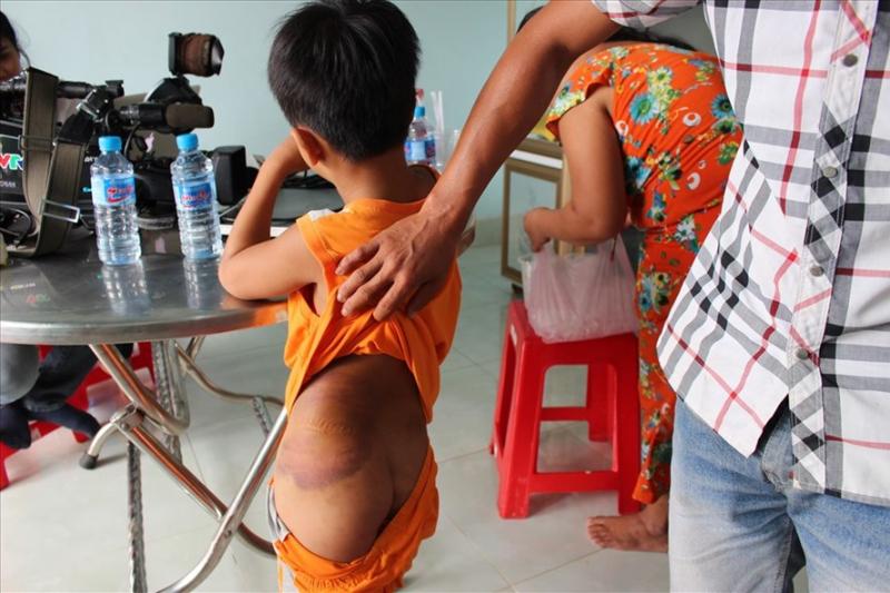 Vụ giáo viên đánh học sinh bầm mông: Do mẹ học sinh... nhờ đánh-1