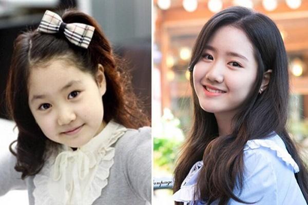 Những sao nhí Hàn lột xác thành thiếu nữ xinh đẹp, quyến rũ-1