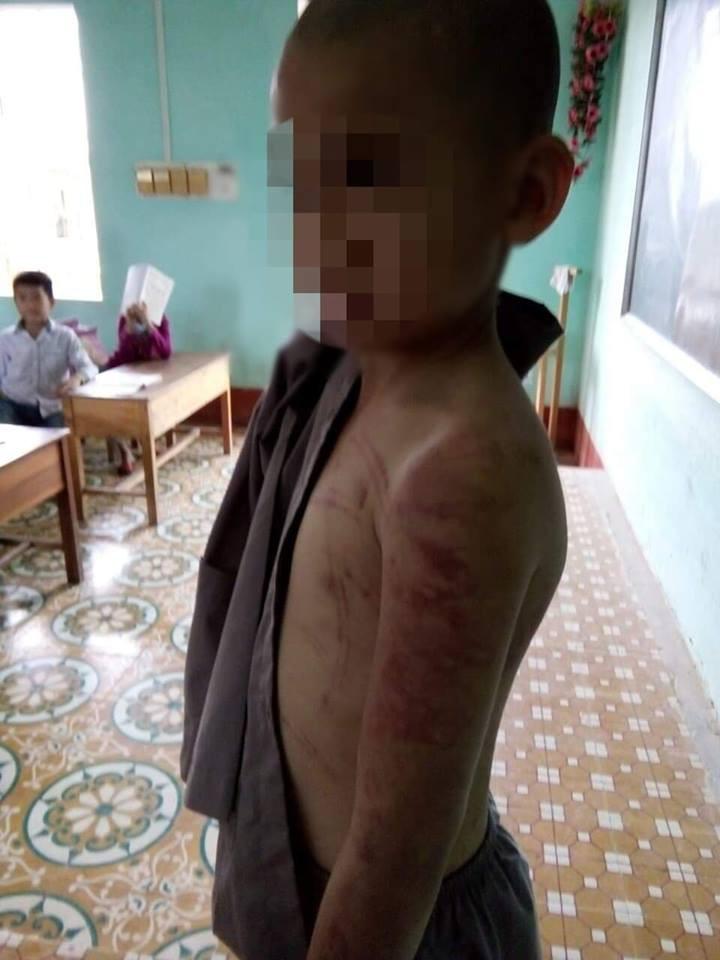 Thanh Hóa: Cháu bé mồ côi bị sư thầy đánh bầm tím khắp cơ thể-1