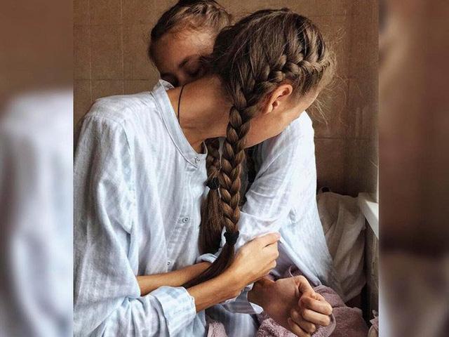 Cặp song sinh người mẫu không khác gì bộ xương di động vì ăn kiêng cực đoan-6