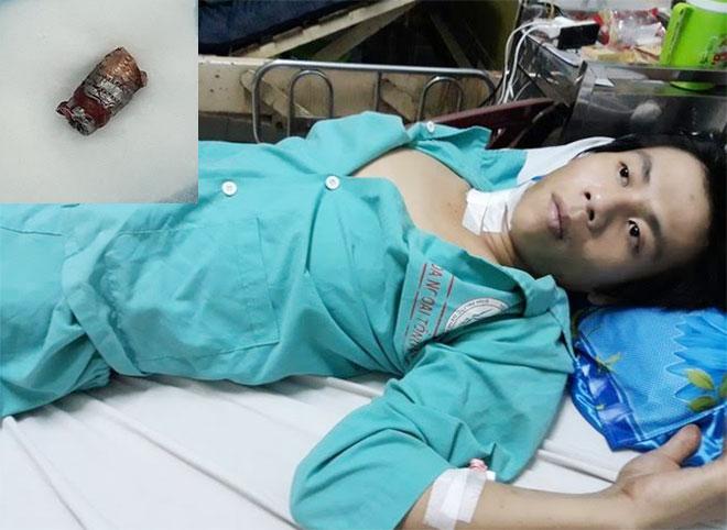 Suýt chết vì bị súng bút bắn đạn ghim cổ-1