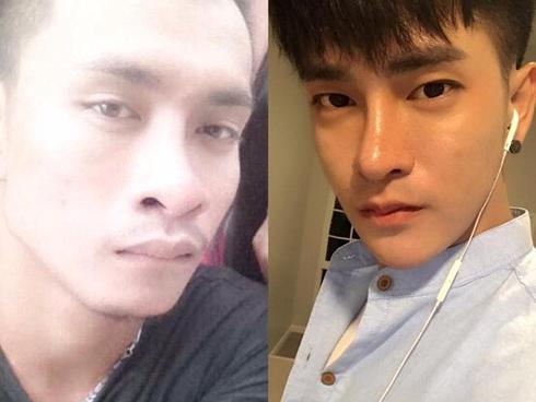 Thanh niên 25 tuổi chi bội tiền cho 30 cuộc phẫu thuật thẩm mỹ để giống trai Hàn