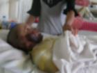 Thai phụ bỏng nặng, mất con vì treo xăng ở trong bếp