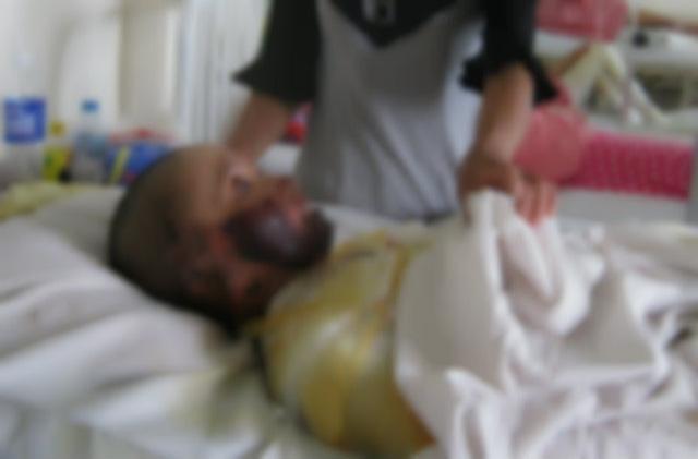 Thai phụ bỏng nặng, mất con vì treo xăng ở trong bếp-1