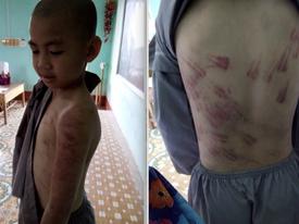 Vụ cháu bé bị ni cô đánh đập ở Thanh Hoá: Cô giáo chủ nhiệm lên tiếng tố giác Vụ cháu bé bị ni cô đánh đập ở Thanh Hoá: Cô giáo chủ nhiệm lên tiếng tố giác