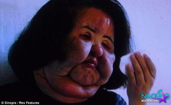 Thảm họa thẩm mỹ xứ Hàn qua đời ở tuổi 57: Dùng cả tuổi thanh xuân để dao kéo, tự mua dầu ăn về tiêm lên mặt-2