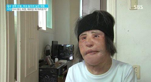Thảm họa thẩm mỹ xứ Hàn qua đời ở tuổi 57: Dùng cả tuổi thanh xuân để dao kéo, tự mua dầu ăn về tiêm lên mặt-6