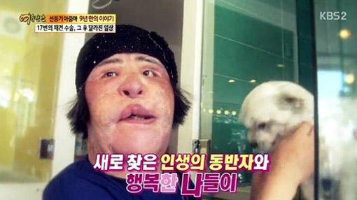 Thảm họa thẩm mỹ xứ Hàn qua đời ở tuổi 57: Dùng cả tuổi thanh xuân để dao kéo, tự mua dầu ăn về tiêm lên mặt-5