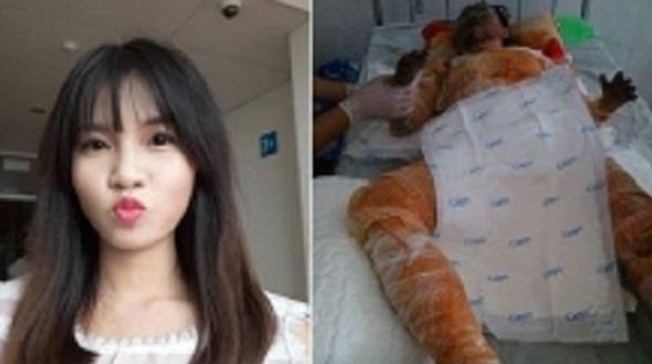 Kéo dài đôi chân cong như rễ cây giúp Hoàng tử ếch đi lại được sau 28 năm-3