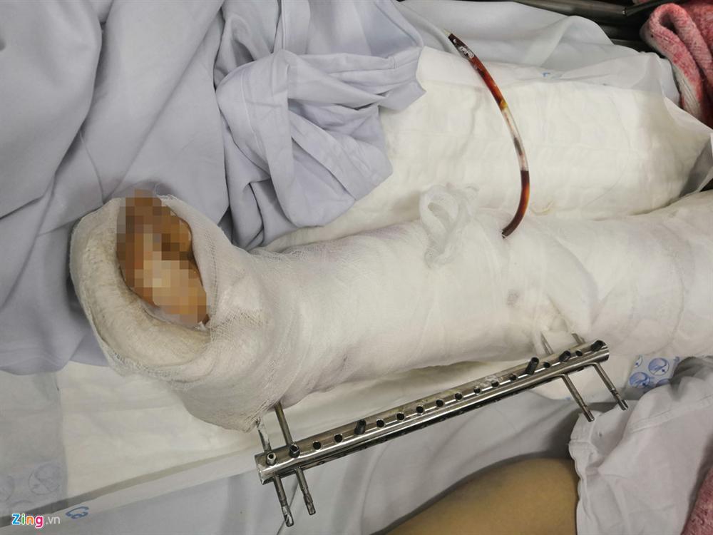 Nữ giáo viên trong vụ xe Lexus đâm liên hoàn: Kinh khủng lắm-2