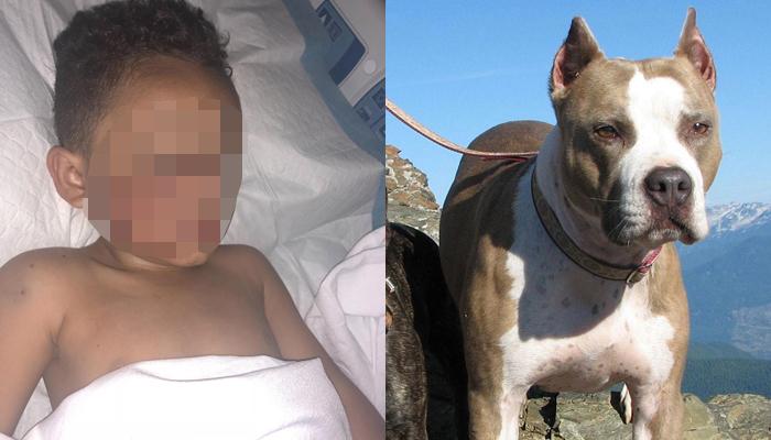 Mẹ kể lại giây phút con trai bị chó pitbull cắn nát khuôn mặt trong đau đớn-2