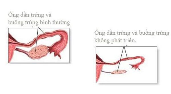 Mẹ 40 tuổi vẫn đến kỳ đều đặn, con gái 17 tuổi đã mãn kinh-2