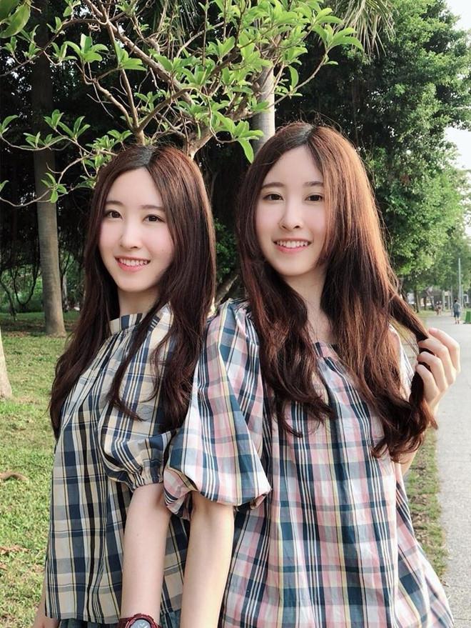 Cặp song sinh nổi tiếng ở Đài Loan 15 năm trước giờ ra sao?-6