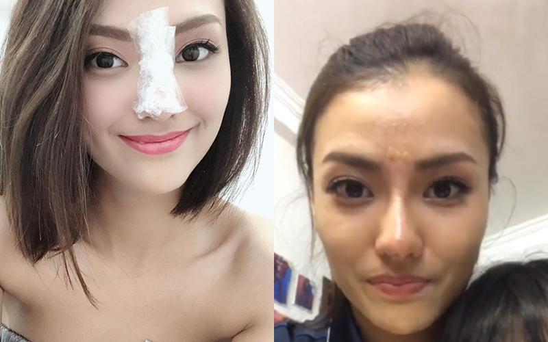 Muôn kiểu đáp trả của mỹ nhân Việt khi gương mặt vướng thị phi đập đi xây lại trong năm 2018-11