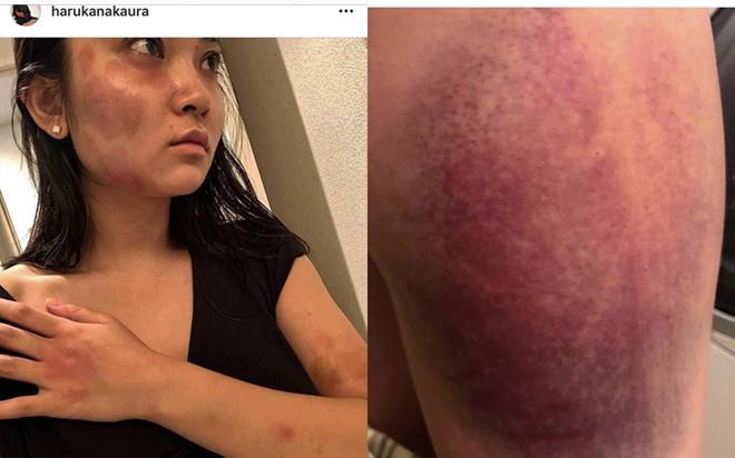 Tài tử Trung Quốc lần đầu lên tiếng khi bị bắt vì hành hung bạn gái-2