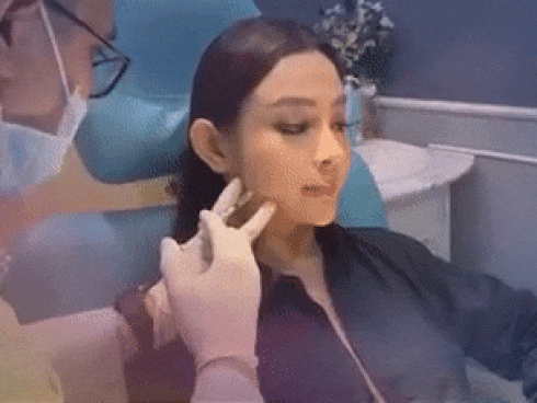 Cứ 6 tháng lại mang gương mặt đi 'can thiệp' bảo sao Huyền Baby mỗi ngày một đẹp