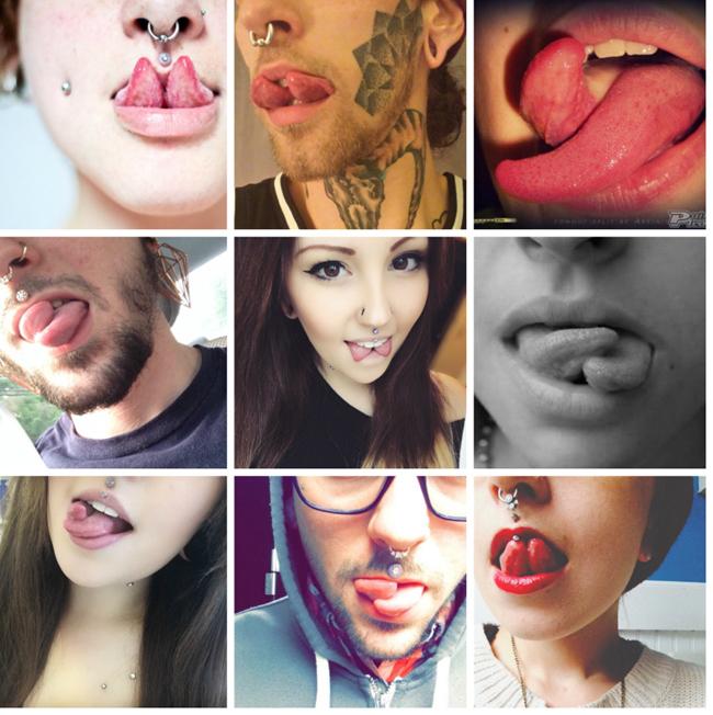 Trào lưu tách lưỡi của giới trẻ với những biến chứng khủng khiếp-1