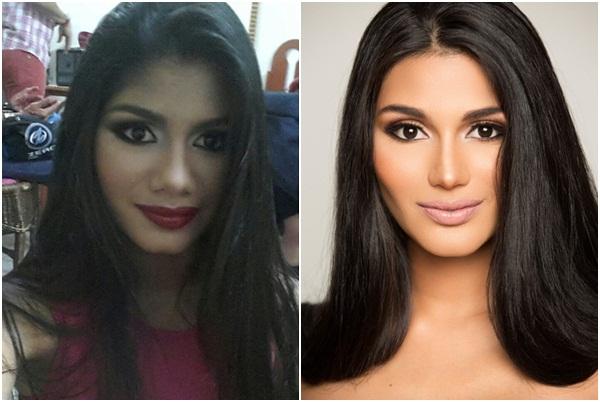 Giật mình với nhan sắc đập đi xây lại của những hoa hậu Venezuela nổi tiếng nhất thế giới-7