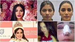 Giật mình với nhan sắc 'đập đi xây lại' của những hoa hậu Venezuela nổi tiếng nhất thế giới