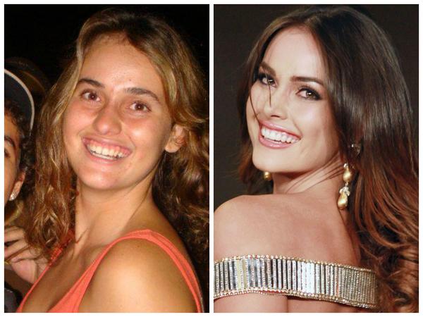 Giật mình với nhan sắc đập đi xây lại của những hoa hậu Venezuela nổi tiếng nhất thế giới-18