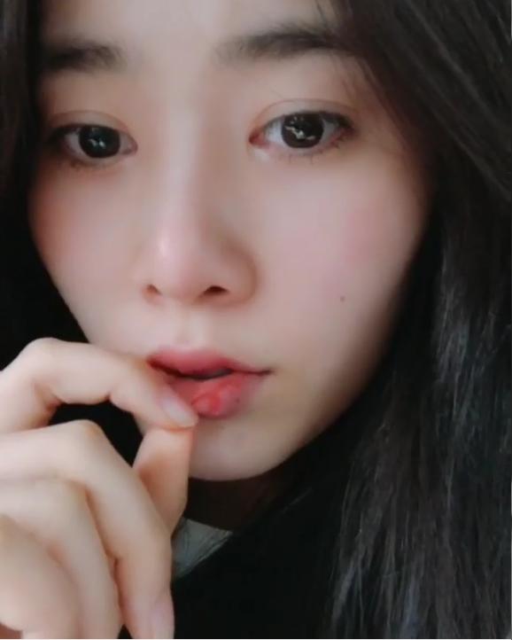 Sau khi va chạm giao thông, Nam Em quá buồn nên lột da môi trên nền nhạc Diên Hi Công Lược-2