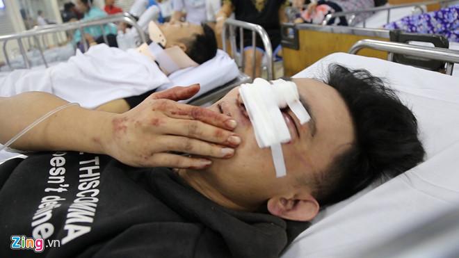 Vụ container tông hàng loạt xe máy: Chiếc xe điên lao như sóng thần-2