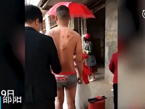 Chú rể nhọ nhem nhất năm: Ngã bầm tím mặt mày ngay trước ngày cưới-3