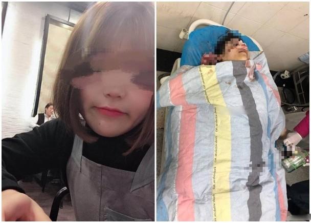 Xôn xao cô gái 19 tuổi qua đời bí ẩn và loạt cái chết gây chấn động chỉ vì bất chấp để được đẹp-2