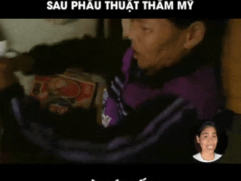 Top 3 cuộc phẫu thuật thẩm mỹ đổi đời gây xôn xao mạng xã hội năm 2018-13