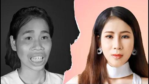 HY HỮU: Cô gái trở nên xinh đẹp sau thẩm mỹ suýt bị mẹ đuổi đi vì không nhận ra con gái-1