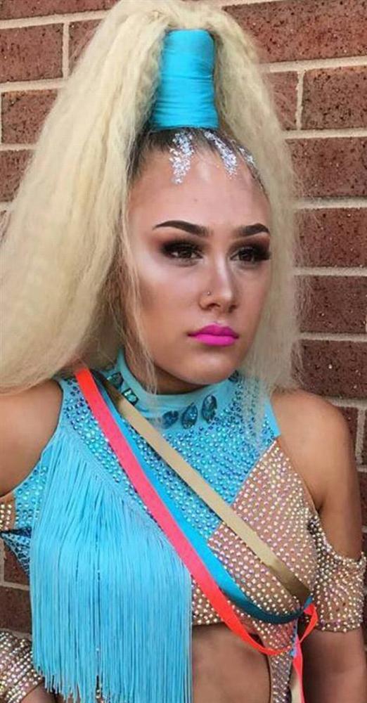 Nữ vũ công 15 tuổi qua đời đột ngột sau vài ngày đau đầu-1