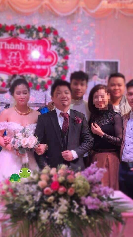 Chú rể nhọ nhem nhất năm: Ngã bầm tím mặt mày ngay trước ngày cưới-1