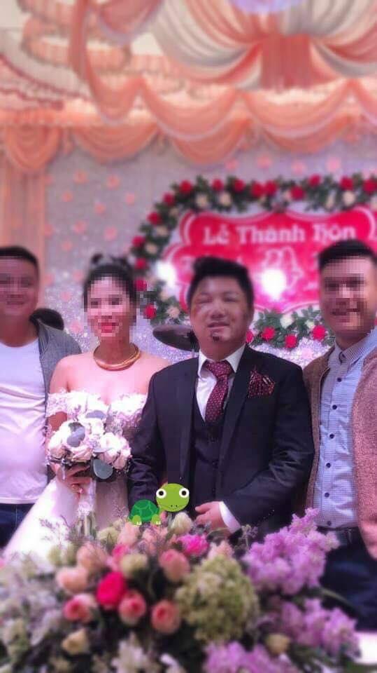 Chú rể nhọ nhem nhất năm: Ngã bầm tím mặt mày ngay trước ngày cưới-2