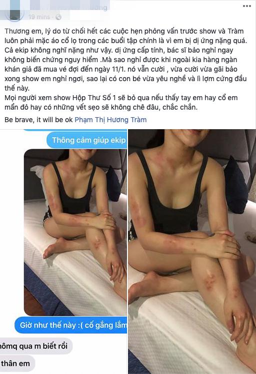 Hương Tràm bị chẩn đoán dị ứng cấp tính, bác sĩ yêu cầu nghỉ hát dù vừa trải qua chứng bệnh xé da tay chảy máu tươi-2