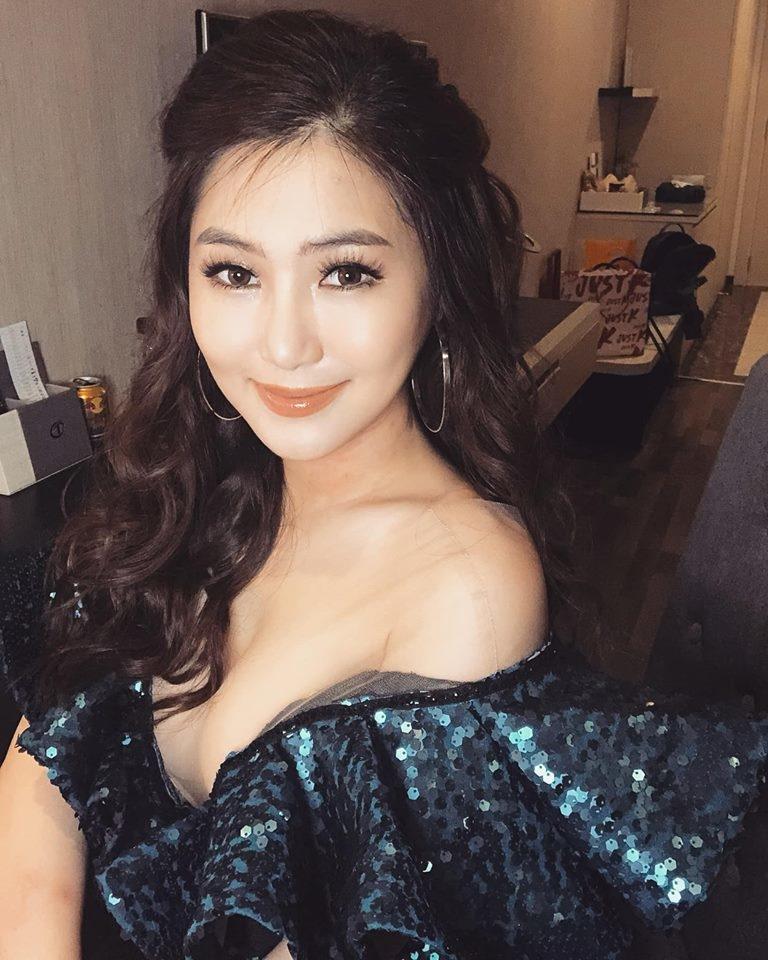 Hương Tràm bị chẩn đoán dị ứng cấp tính, bác sĩ yêu cầu nghỉ hát dù vừa trải qua chứng bệnh xé da tay chảy máu tươi-1