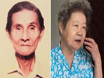 Sau cơn ho, người đàn ông rơi răng giả vào khí quản-3